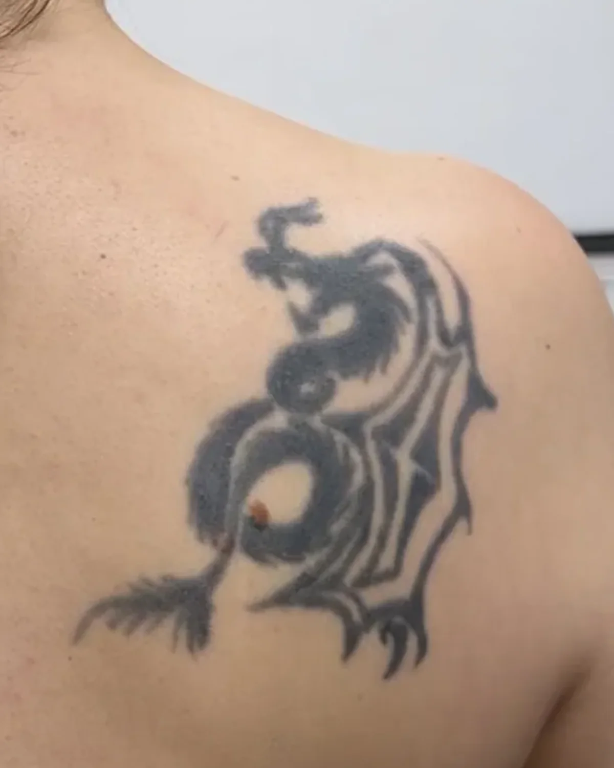Vorher: altes Tribal-Drachen-Tattoo am Schulterblatt | Cover-up bei Tattoo-Highlights Hamburg